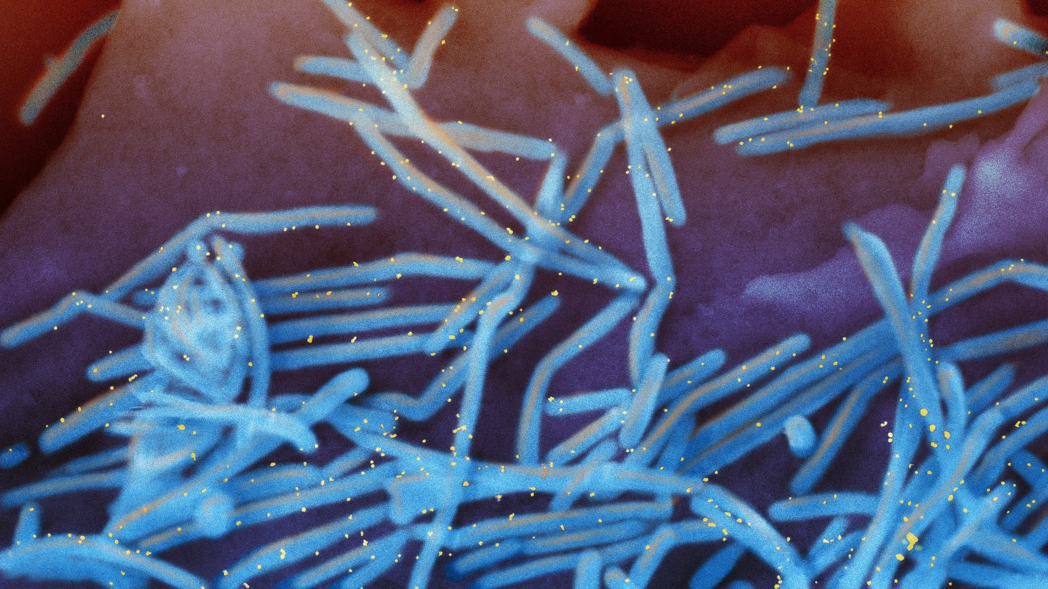 RSV antibodies cut infant hospital care in Sweden