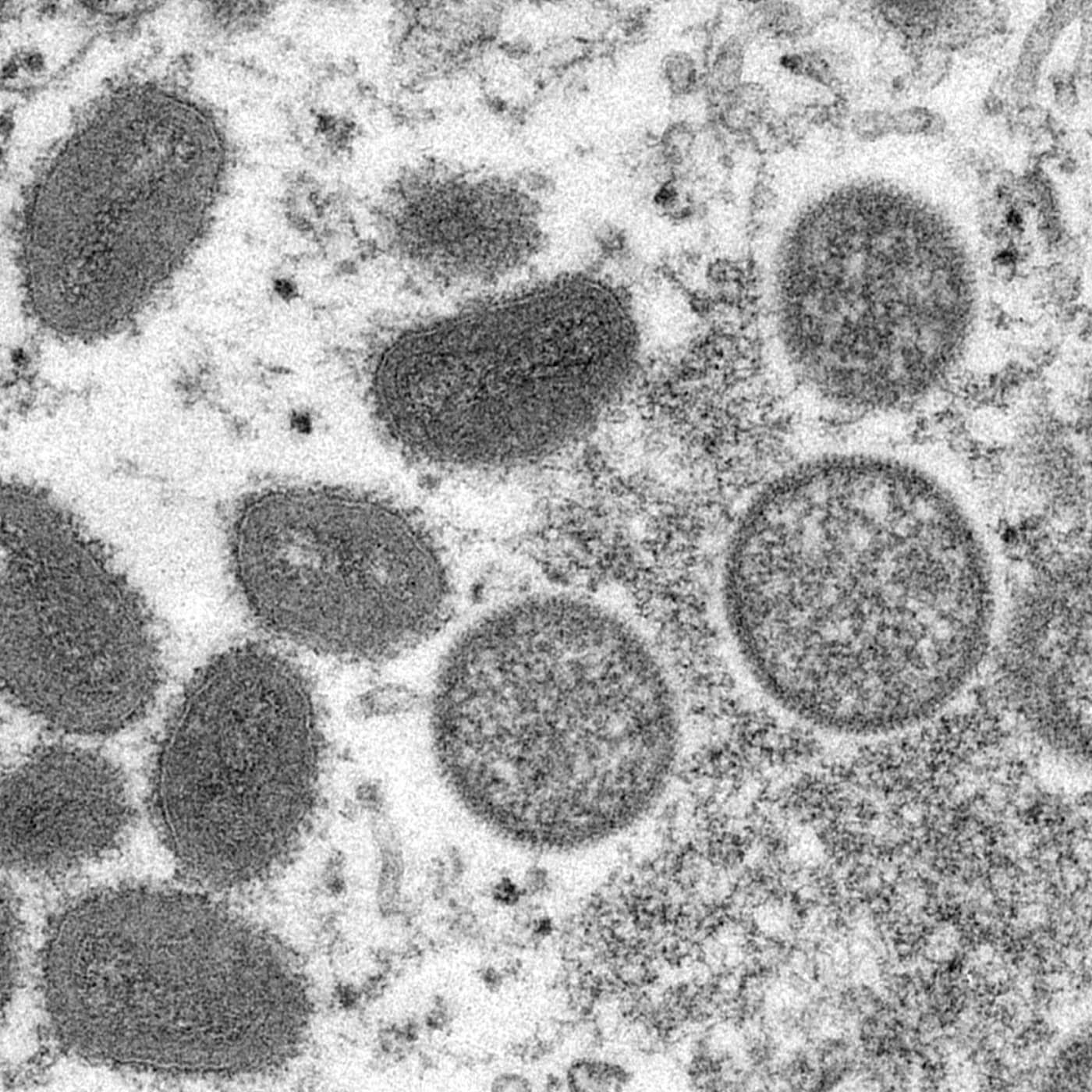 Monkeypox gets public health classification, Kakabaveh pulls support, Arlanda Airport reopening terminal, Benjamin Ingrosso wins top Grammis