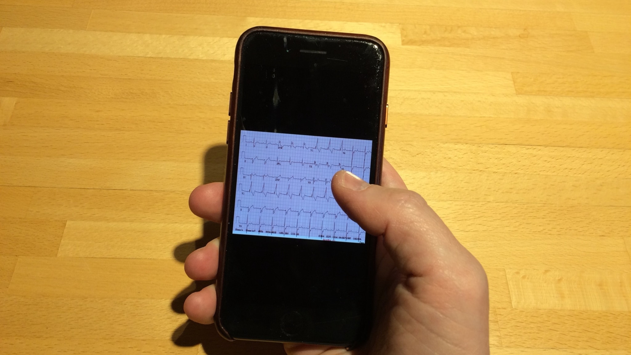 App För Att Mäta Yta
