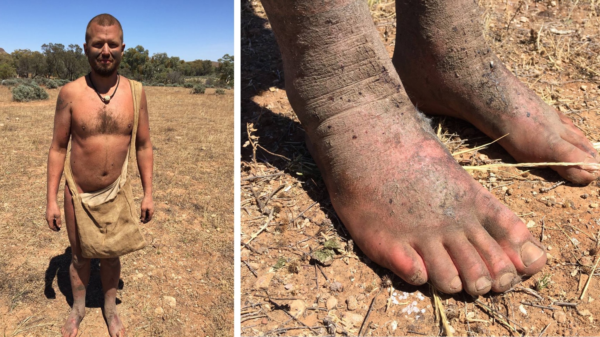 Nicklas Lautakoski naken i Australien: Mitt livs tuffaste äventyr 